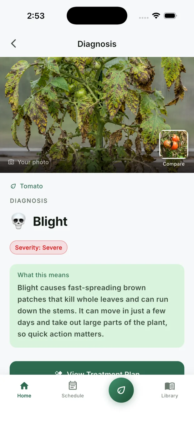 The diagnosis screen showing the user's own tomato leaf photo, labelled tomato early blight, with a severity read